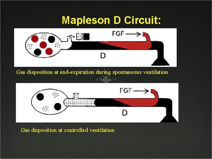 Mapleson D Circuit: Gas disposition at end-expiration during spontaneous ventilation Gas disposition at controlled