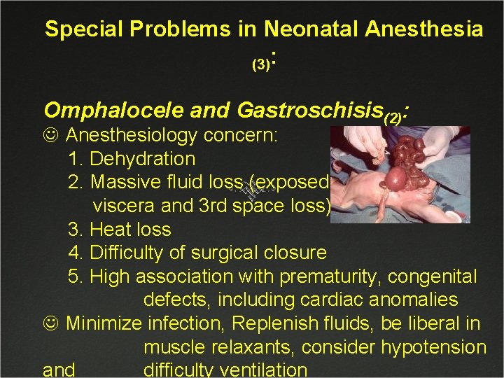 Special Problems in Neonatal Anesthesia (3): Omphalocele and Gastroschisis(2): J Anesthesiology concern: 1. Dehydration