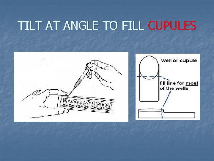 TILT AT ANGLE TO FILL CUPULES 