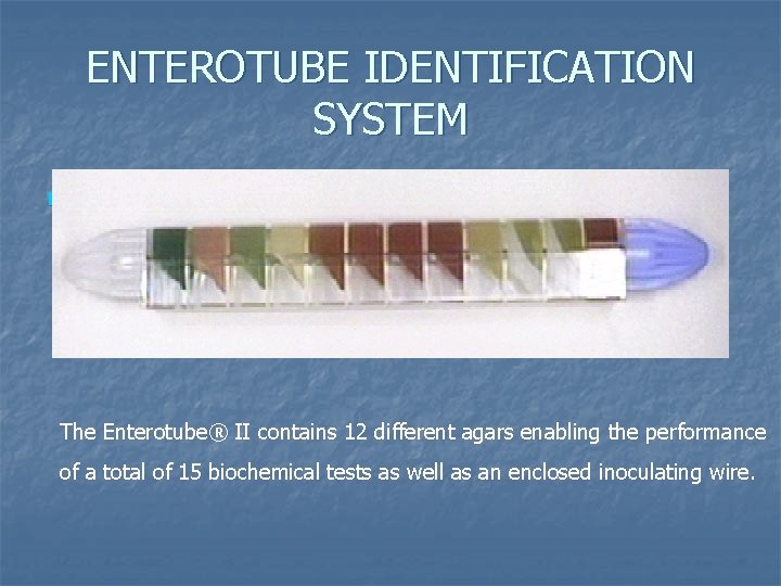 ENTEROTUBE IDENTIFICATION SYSTEM n The Enterotube® II contains 12 different agars enabling the performance ENTEROTUBE IDENTIFICATION SYSTEM n The Enterotube® II contains 12 different agars enabling the performance