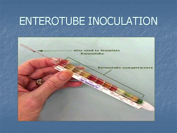 ENTEROTUBE INOCULATION ENTEROTUBE INOCULATION