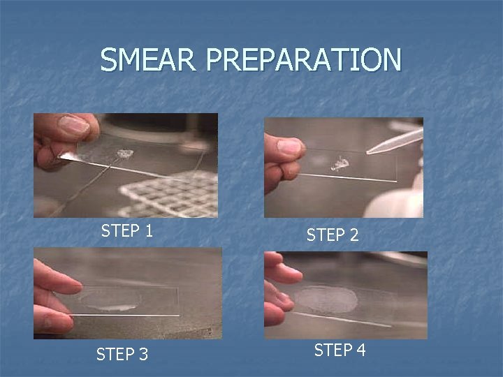 SMEAR PREPARATION STEP 1 STEP 3 STEP 2 STEP 4 SMEAR PREPARATION STEP 1 STEP 3 STEP 2 STEP 4