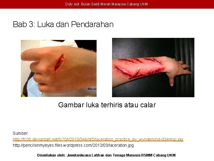 Duty slot Bulan Sabit Merah Malaysia Cabang UKM Bab 3: Luka dan Pendarahan Gambar