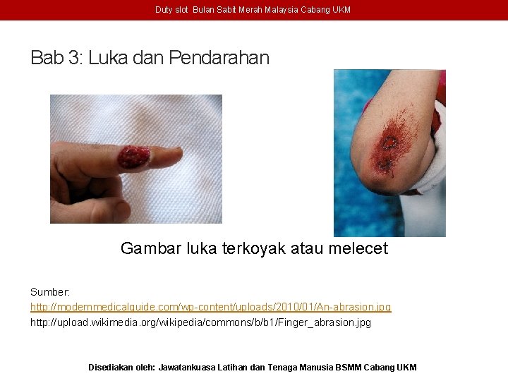 Duty slot Bulan Sabit Merah Malaysia Cabang UKM Bab 3: Luka dan Pendarahan Gambar