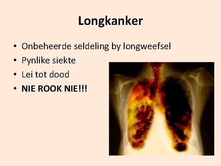 Longkanker • • Onbeheerde seldeling by longweefsel Pynlike siekte Lei tot dood NIE ROOK