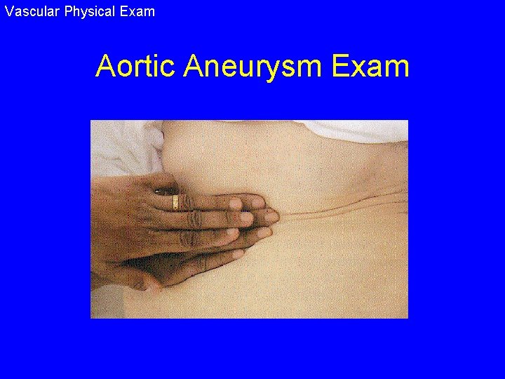 Vascular Physical Exam Aortic Aneurysm Exam 