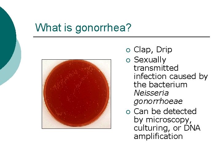 What is gonorrhea? ¡ ¡ ¡ Clap, Drip Sexually transmitted infection caused by the