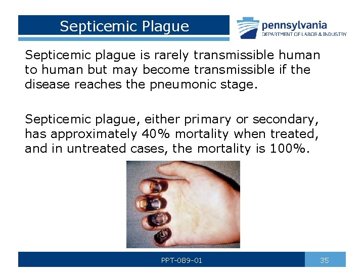 Septicemic Plague Septicemic plague is rarely transmissible human to human but may become transmissible