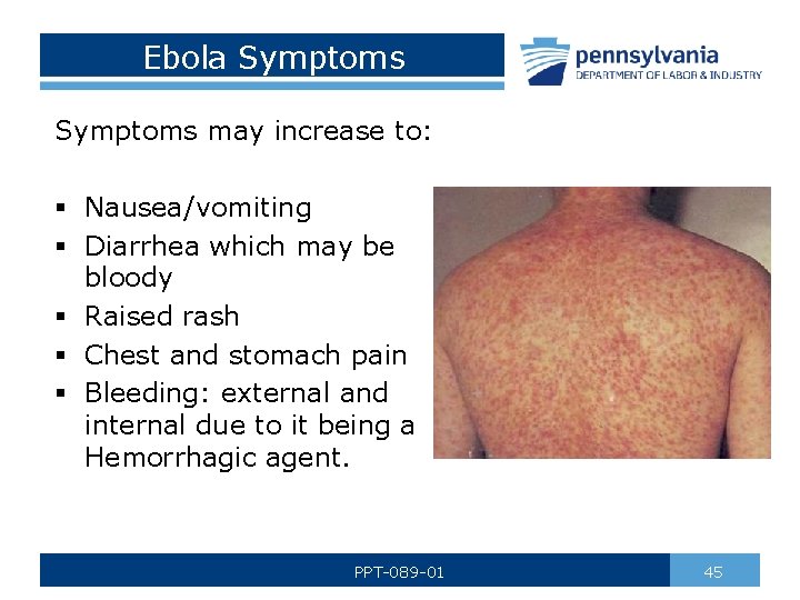 Ebola Symptoms may increase to: § Nausea/vomiting § Diarrhea which may be bloody §