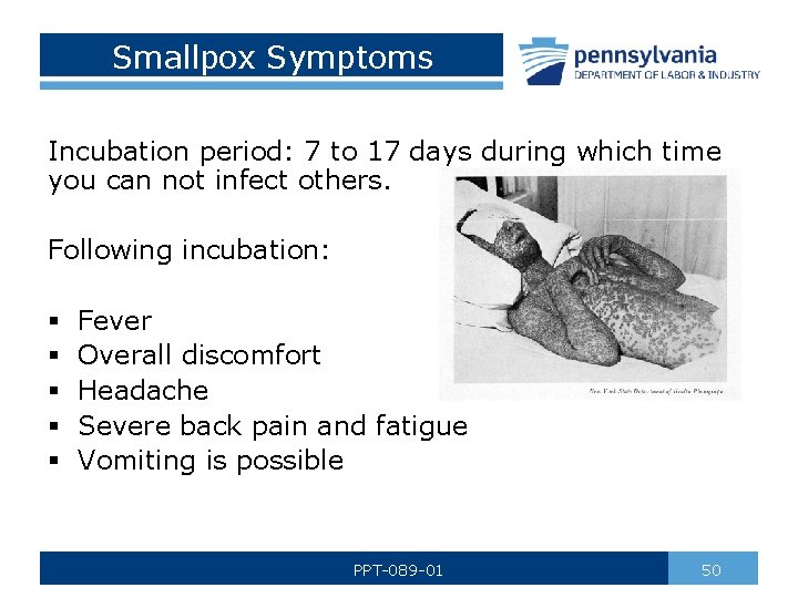 Smallpox Symptoms Incubation period: 7 to 17 days during which time you can not