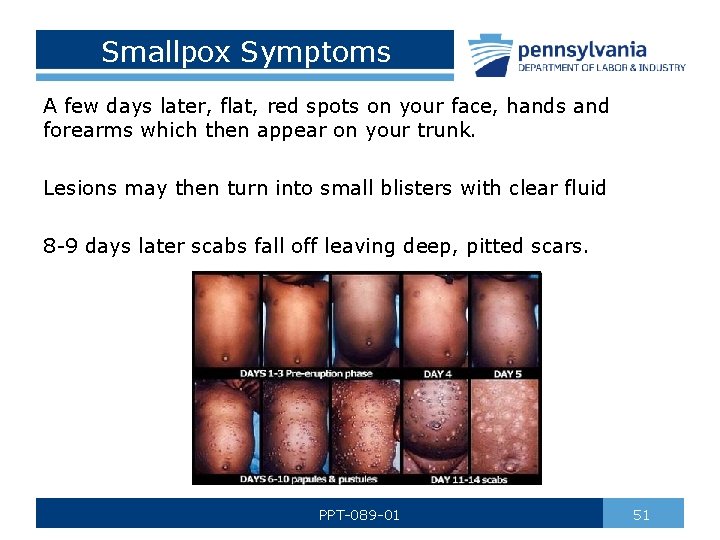 Smallpox Symptoms A few days later, flat, red spots on your face, hands and
