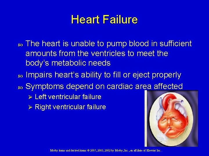 Heart Failure The heart is unable to pump blood in sufficient amounts from the