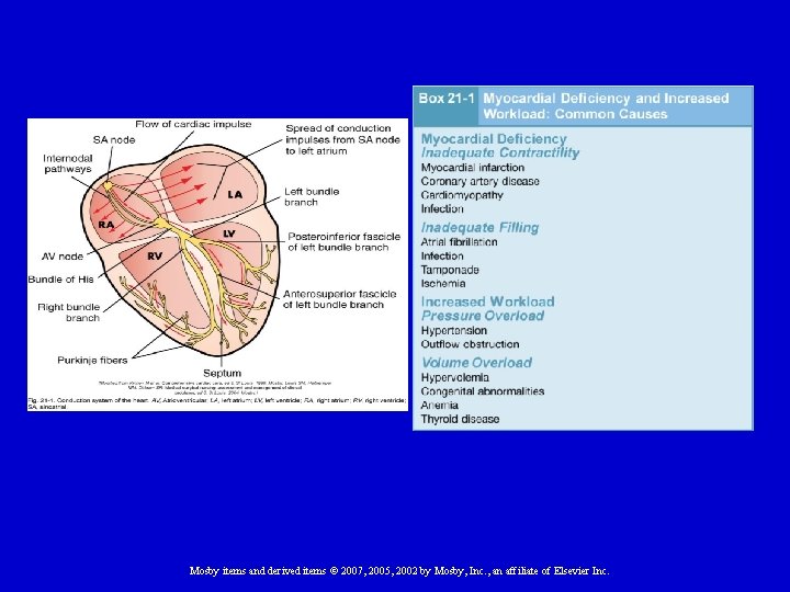 Mosby items and derived items © 2007, 2005, 2002 by Mosby, Inc. , an