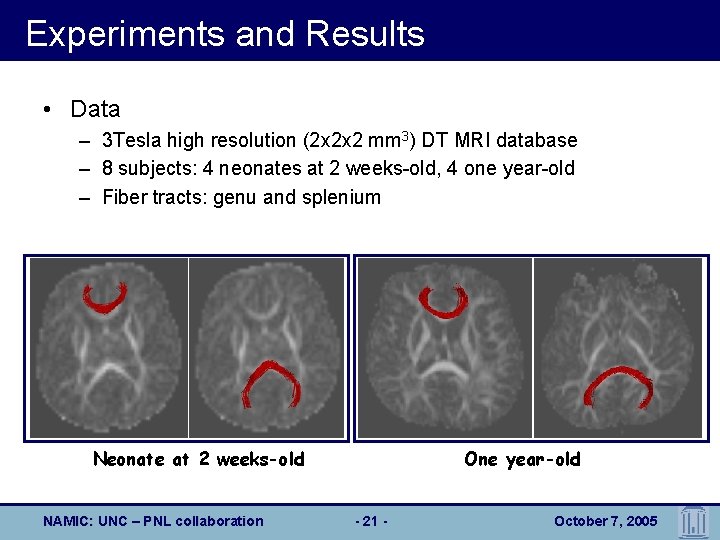Experiments and Results • Data – 3 Tesla high resolution (2 x 2 x