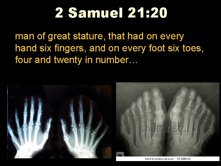 2 Samuel 21: 20 man of great stature, that had on every hand six