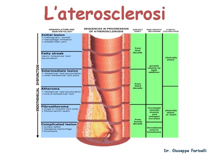L’aterosclerosi Dr. Giuseppe Fariselli 