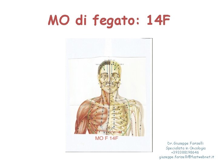 MO di fegato: 14 F Dr. Giuseppe Fariselli Specialista in Oncologia +393388198646 giuseppe. fariselli@fastwebnet.