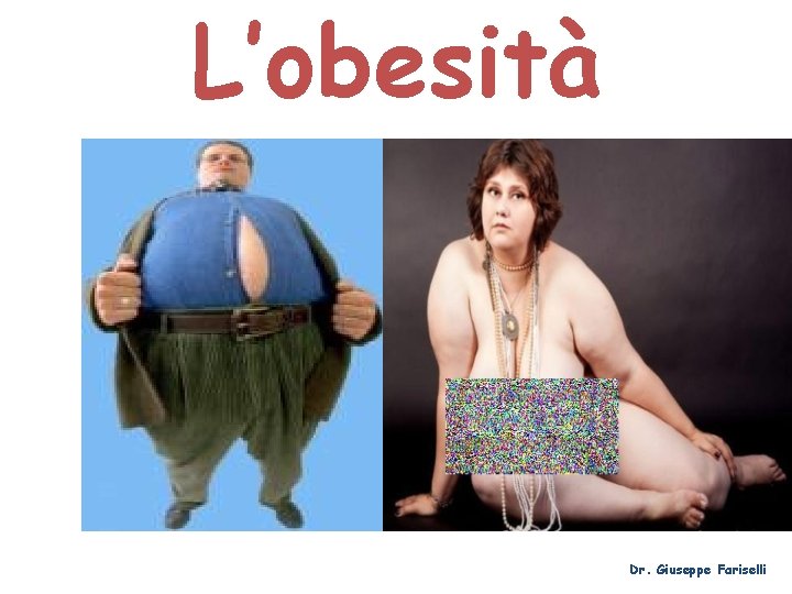 L’obesità Dr. Giuseppe Fariselli 