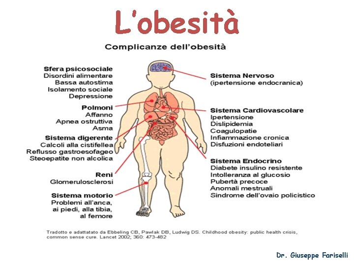 L’obesità Dr. Giuseppe Fariselli 