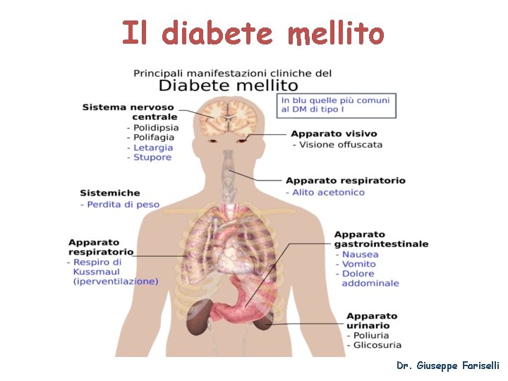 Il diabete mellito Dr. Giuseppe Fariselli 