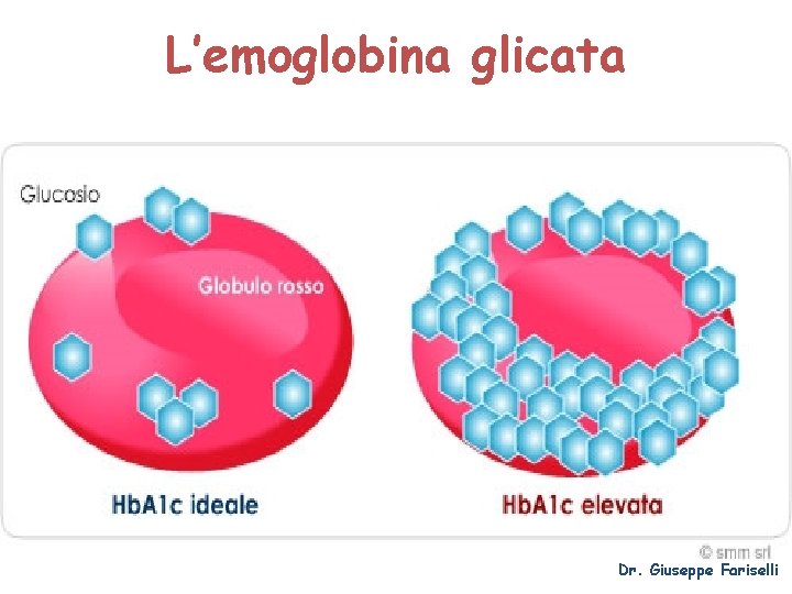 L’emoglobina glicata Dr. Giuseppe Fariselli 