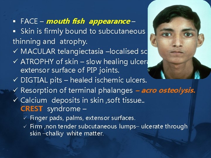 § FACE – mouth fish appearance – § Skin is firmly bound to subcutaneous