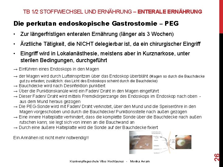 TB 1/2 STOFFWECHSEL UND ERNÄHRUNG – ENTERALE ERNÄHRUNG Die perkutan endoskopische Gastrostomie – PEG