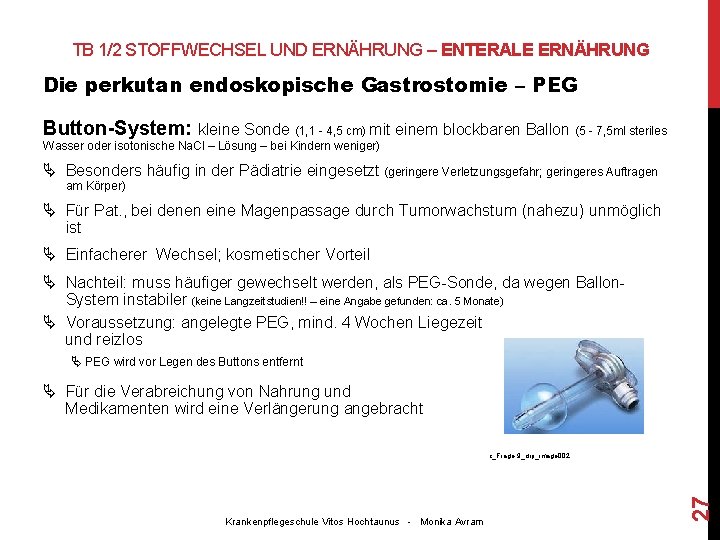 TB 1/2 STOFFWECHSEL UND ERNÄHRUNG – ENTERALE ERNÄHRUNG Die perkutan endoskopische Gastrostomie – PEG