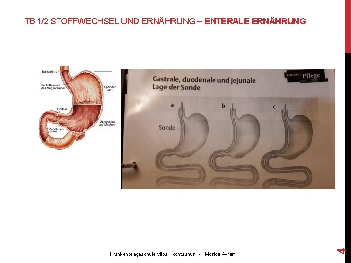 Krankenpflegeschule Vitos Hochtaunus - Monika Avram 4 TB 1/2 STOFFWECHSEL UND ERNÄHRUNG – ENTERALE