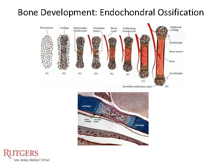 Bone Development: Endochondral Ossification Bone Development: Endochondral Ossification