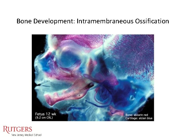 Bone Development: Intramembraneous Ossification Bone Development: Intramembraneous Ossification