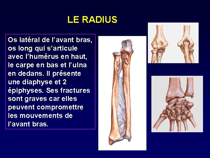 LE RADIUS Os latéral de l’avant bras, os long qui s’articule avec l’humérus en