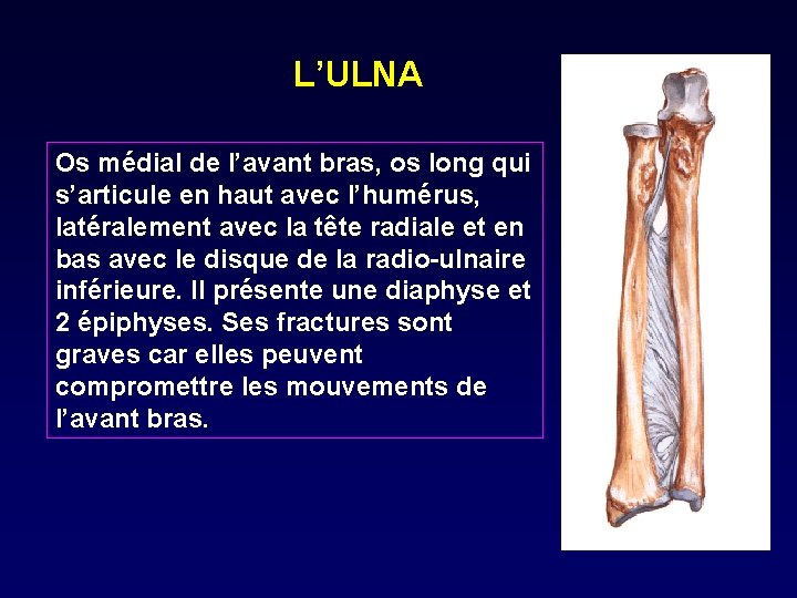 L’ULNA Os médial de l’avant bras, os long qui s’articule en haut avec l’humérus,