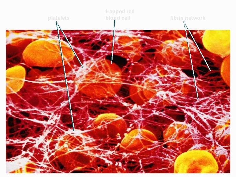 platelets trapped red blood cell fibrin network 