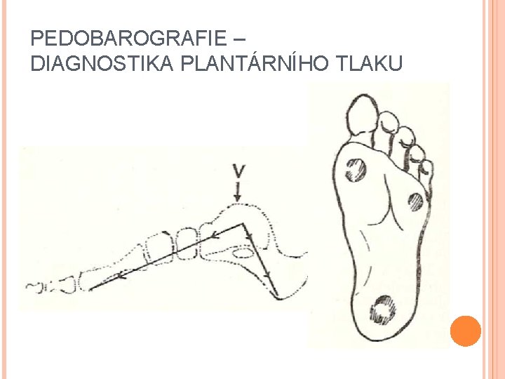 PEDOBAROGRAFIE – DIAGNOSTIKA PLANTÁRNÍHO TLAKU 