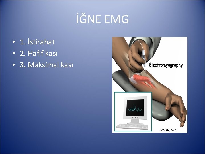 İĞNE EMG • 1. İstirahat • 2. Hafif kası • 3. Maksimal kası 