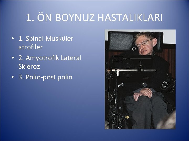 1. ÖN BOYNUZ HASTALIKLARI • 1. Spinal Musküler atrofiler • 2. Amyotrofik Lateral Skleroz