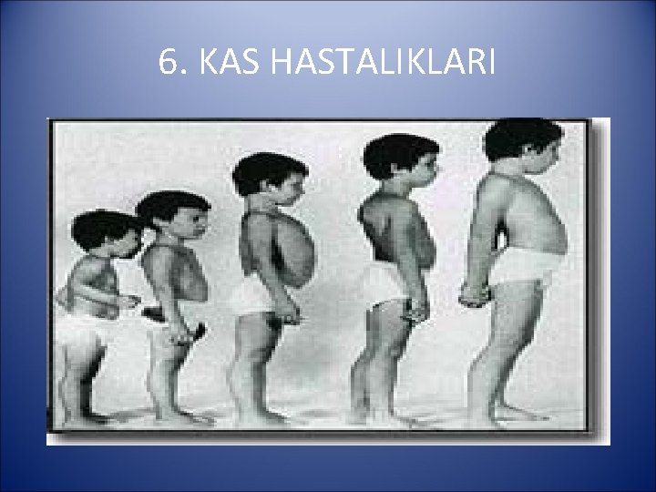 6. KAS HASTALIKLARI 