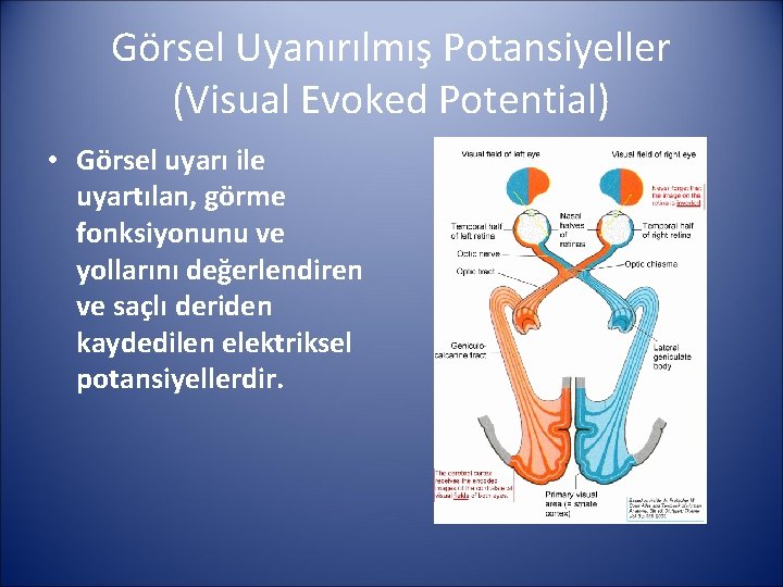 Görsel Uyanırılmış Potansiyeller (Visual Evoked Potential) • Görsel uyarı ile uyartılan, görme fonksiyonunu ve