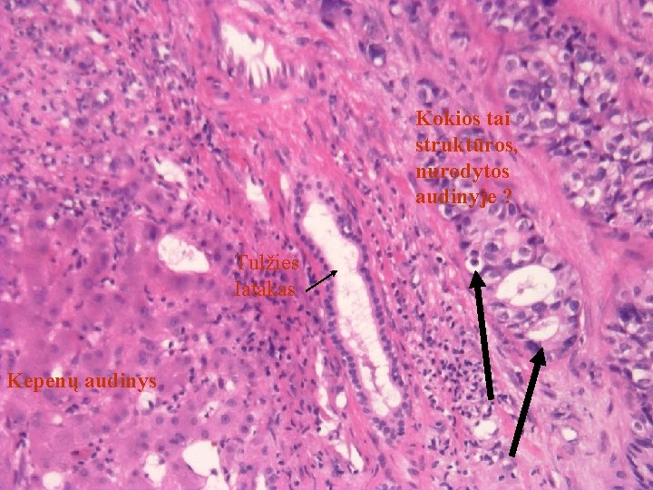 Kokios tai struktūros, nurodytos audinyje ? Tulžies latakas Kepenų audinys 