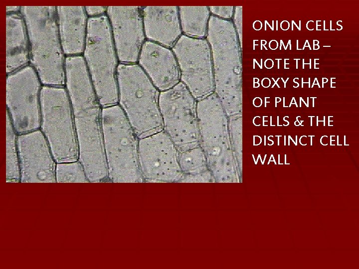 ONION CELLS FROM LAB – NOTE THE BOXY SHAPE OF PLANT CELLS & THE