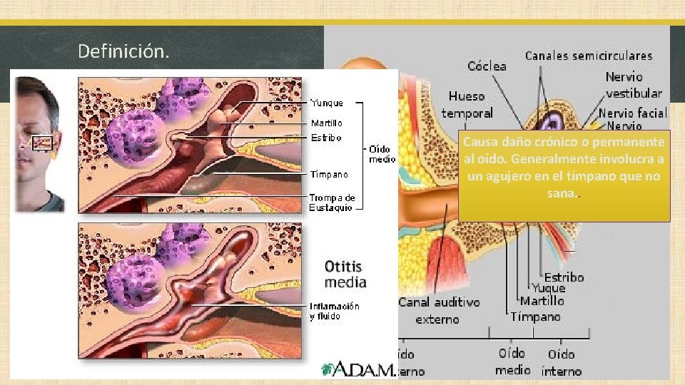 Definición. § Se define como un proceso inflamatorio que afecta al complejo mucoperióstico de