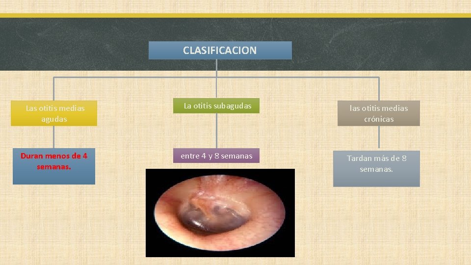 CLASIFICACION Las otitis medias agudas La otitis subagudas las otitis medias crónicas Duran menos