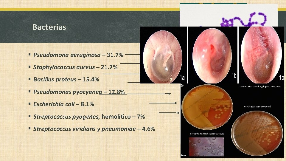 Bacterias § Pseudomona aeruginosa – 31. 7% § Staphylococcus aureus – 21. 7% §