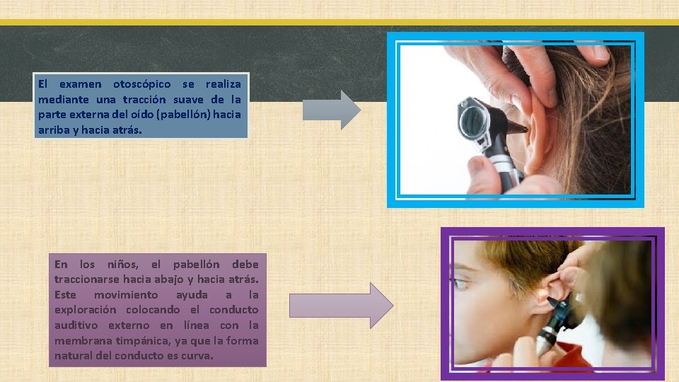 El examen otoscópico se realiza mediante una tracción suave de la parte externa del