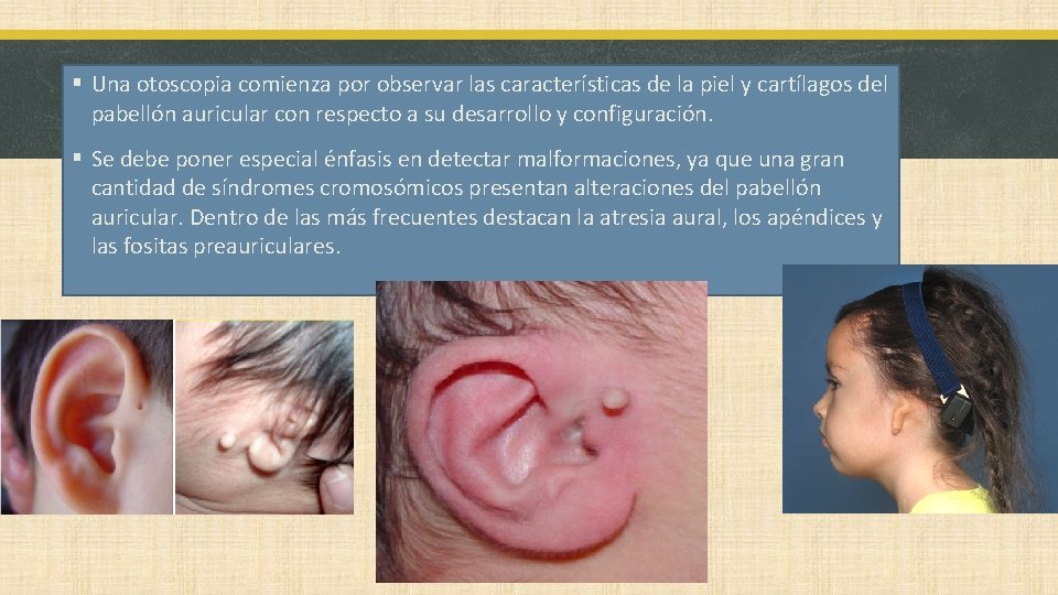 § Una otoscopia comienza por observar las características de la piel y cartílagos del