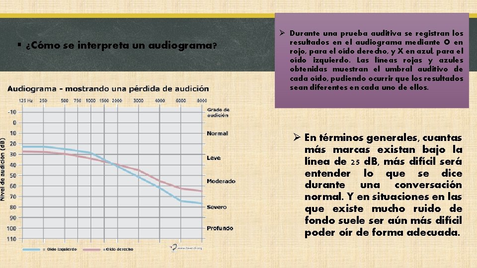 § ¿Cómo se interpreta un audiograma? Ø Durante una prueba auditiva se registran los