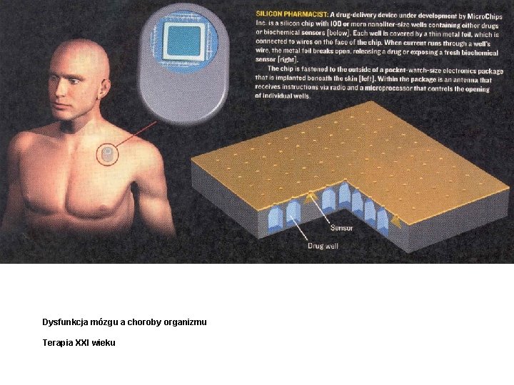 Dysfunkcja mózgu a choroby organizmu Terapia XXI wieku 