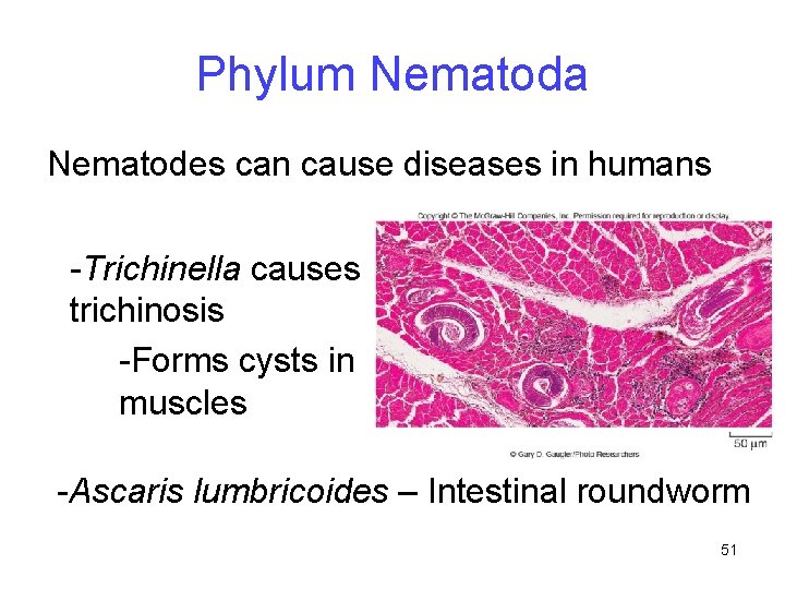 Phylum Nematoda Nematodes can cause diseases in humans -Trichinella causes trichinosis -Forms cysts in