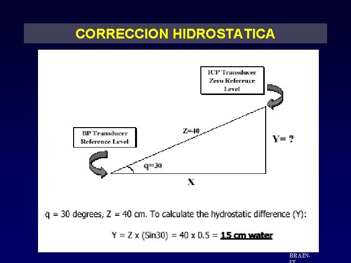 CORRECCION HIDROSTATICA BRAIN- 